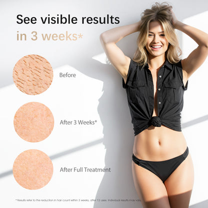 Amotaos IPL Laser Hair Removal